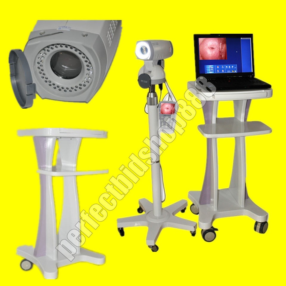 Digital Electronic Colposcope with 830.000 Pixels Sony CCD Camera