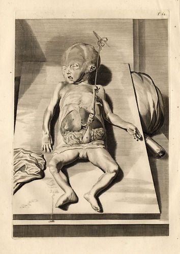 Antique Medical Print Foetus Abdomen Cowper Bidloo 1739